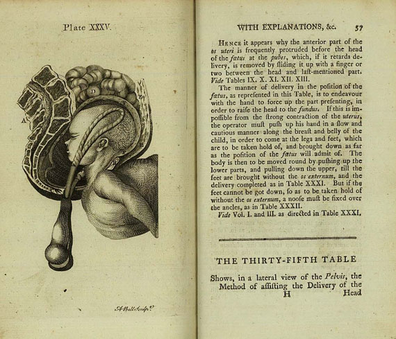 William Smellie - Anatomical Tables, 1755.